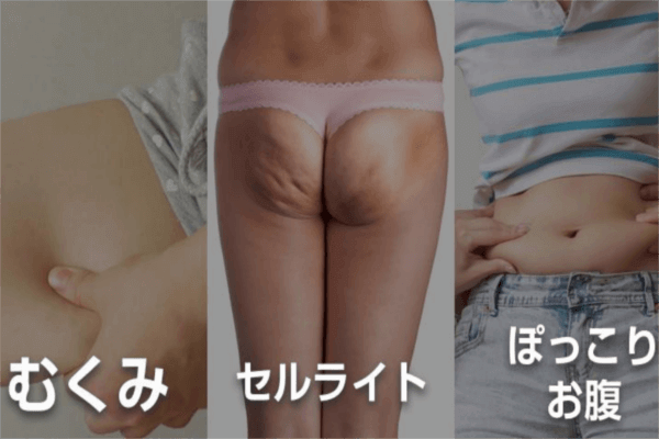 下半身の悩み