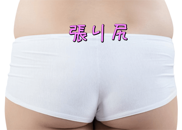 張り尻