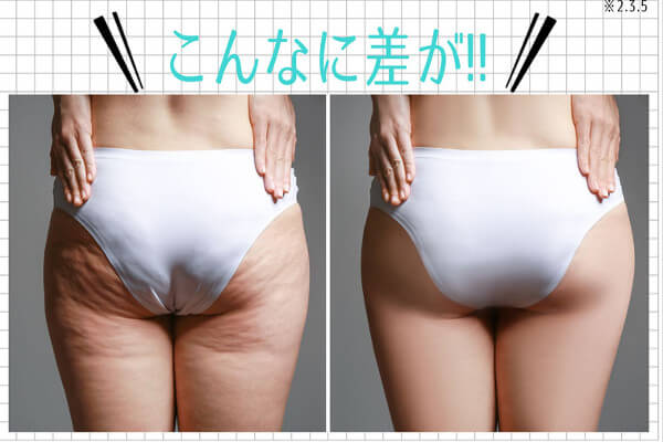 ツルスベヒップと太もも