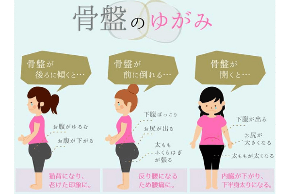 ドクターメディシェイプレギンス骨盤のゆがみ